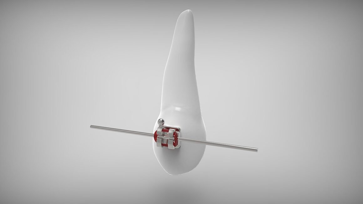 Beyond Bleach: Decoding Modern Teeth Whitening