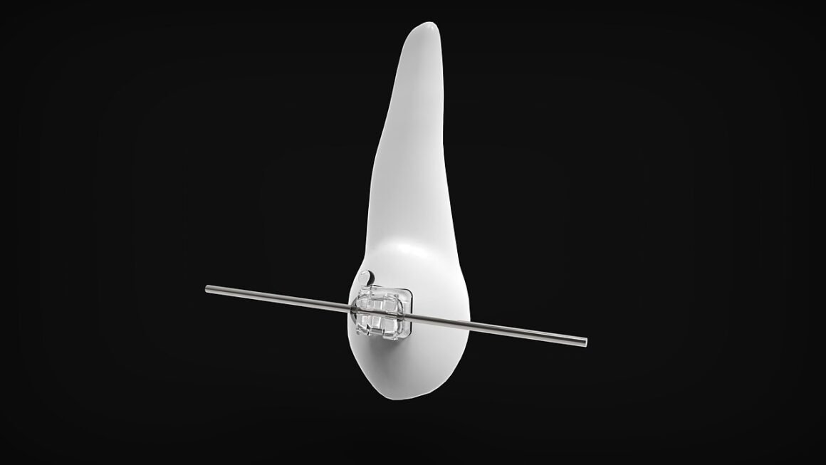 Beyond Bright: Home Whitening, Safety & Sensitivity.