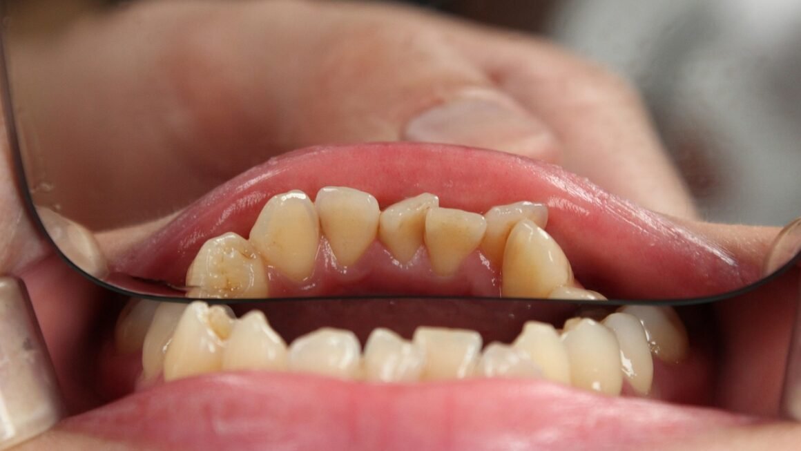 Beyond Braces: The Future Of Personalized Orthodontics